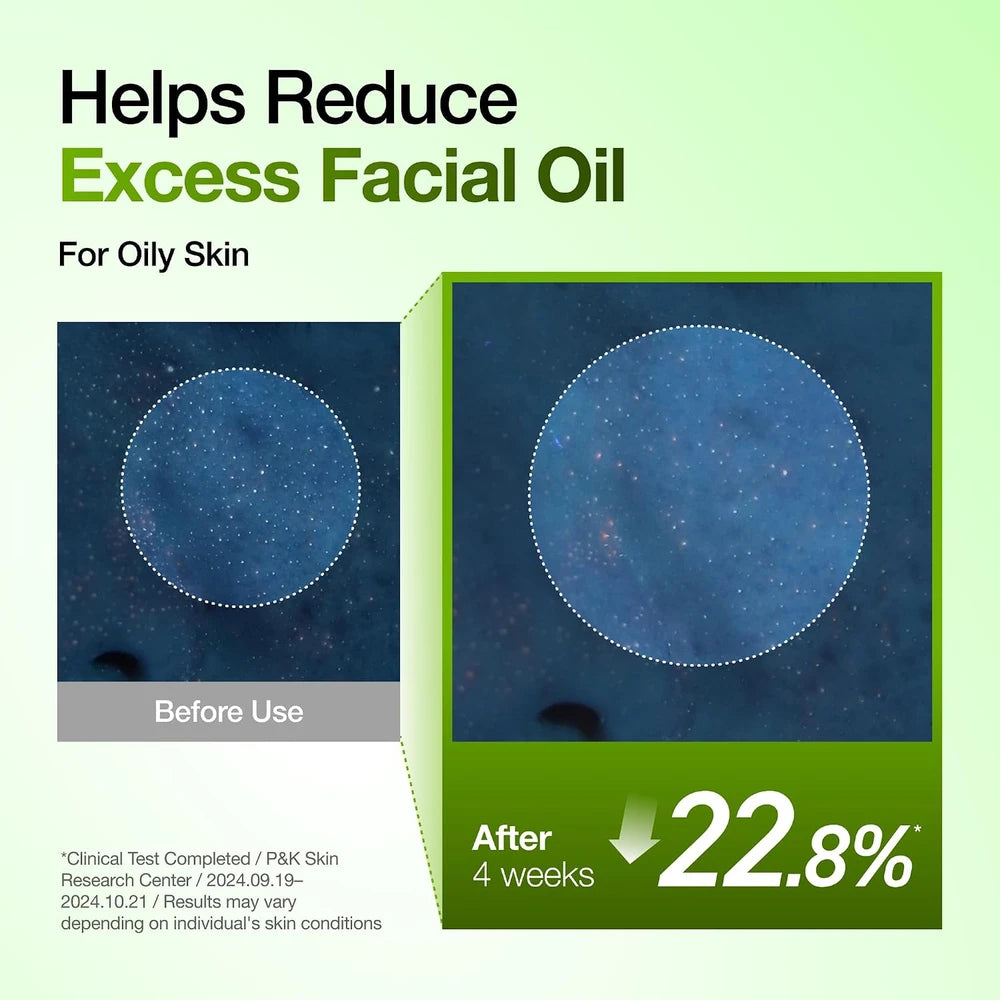Anua Azelaic Acid Redness Soothing Serum