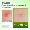 Anua Azelaic Acid Redness Soothing Serum