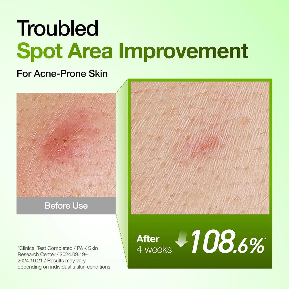 Anua Azelaic Acid Redness Soothing Serum